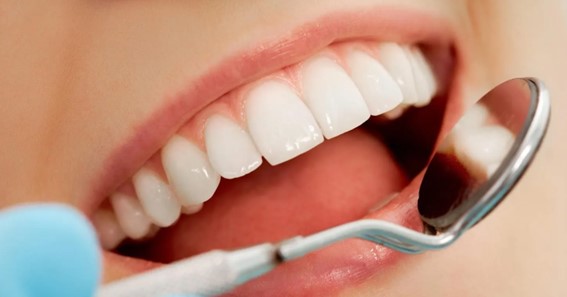 How Much Does it Cost to Restore Your Teeth?