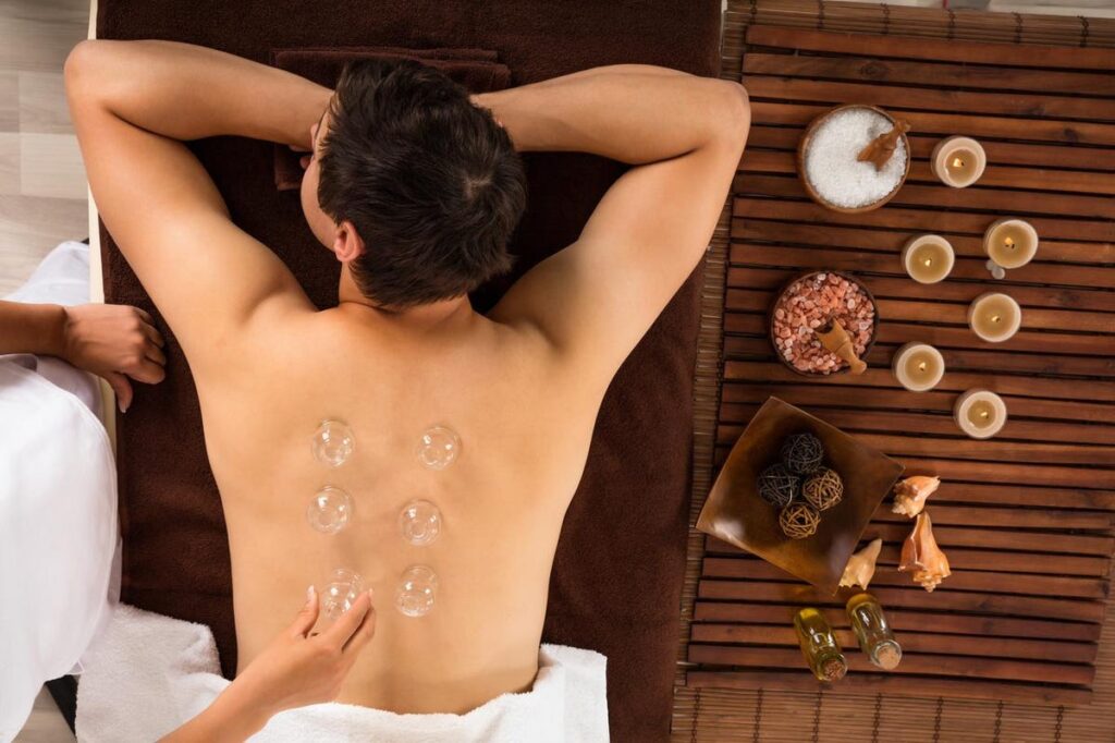 What Does Cupping Therapy Do?