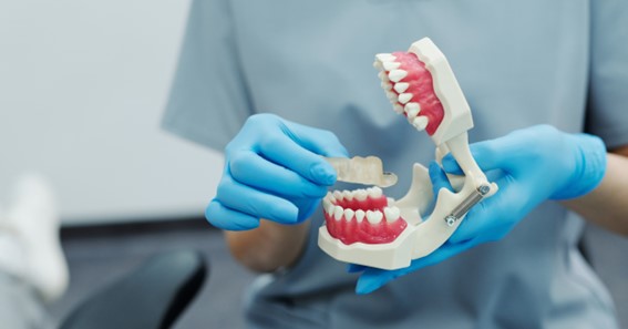 What Are "All on 4" Dental Implants? 